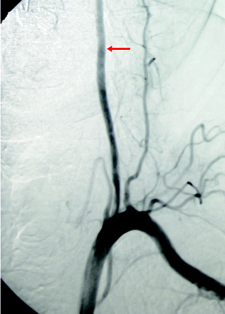 Fig 1.