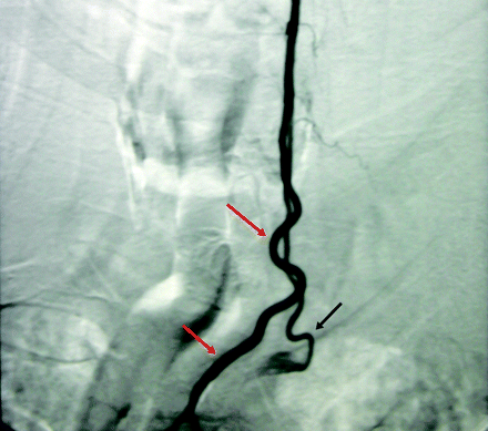 Fig 3.