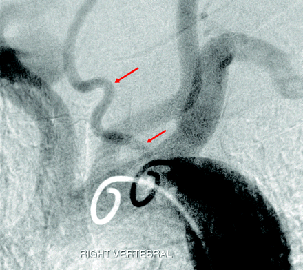 Fig 5.