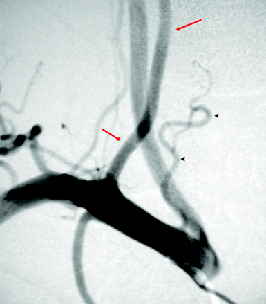 Fig 7.