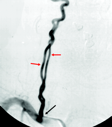 Fig 9.