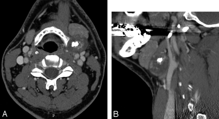   Fig 1. 