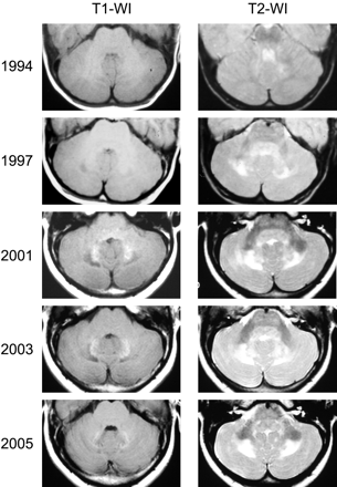 Fig 3.