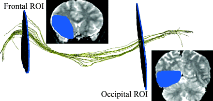 Fig 3.