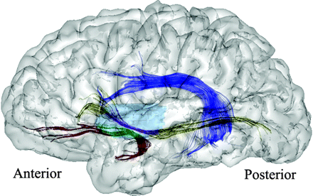 Fig 4.