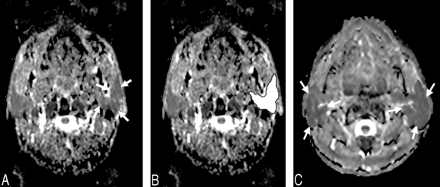 Fig 1.