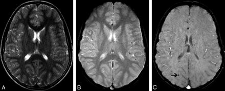 Fig 1.