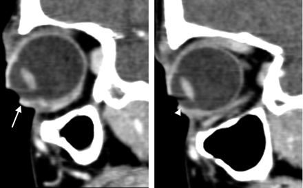 Fig 2.