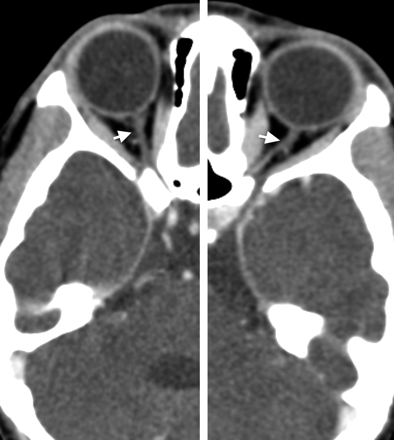 Fig 4.