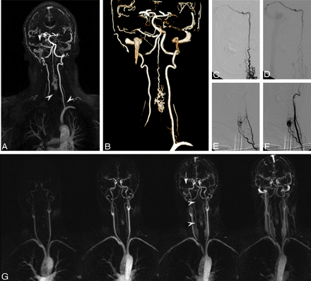 Fig 2.