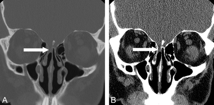 Fig 2.