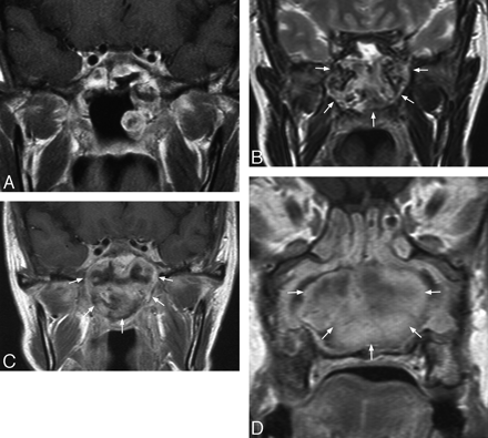 Fig 4.