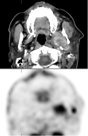 Fig 4.