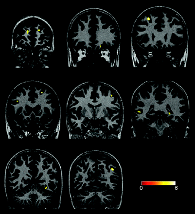 Fig 1.