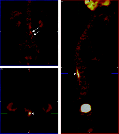 Fig 1.