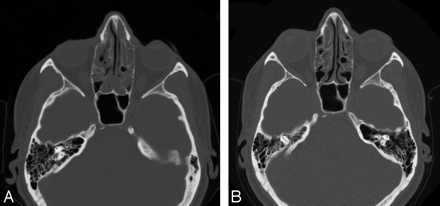 Fig 6.