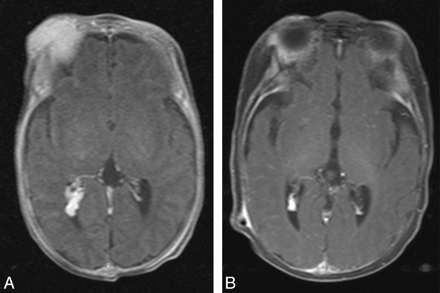 Fig 6.