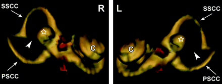 Fig 3.