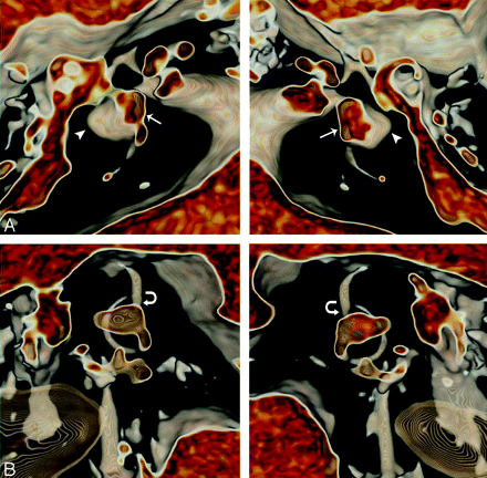 Fig 5.