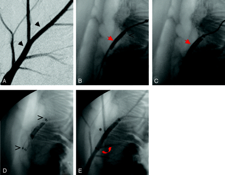 Fig 5.