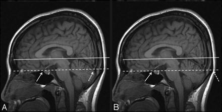 Fig 1.