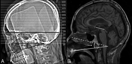 Fig 2.