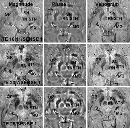Fig 4.