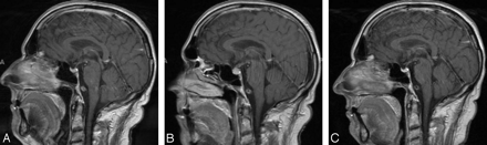 Fig 1.