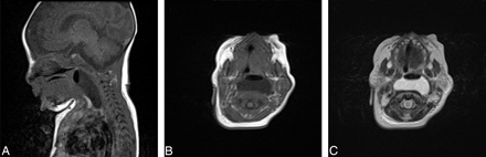 Fig 1.