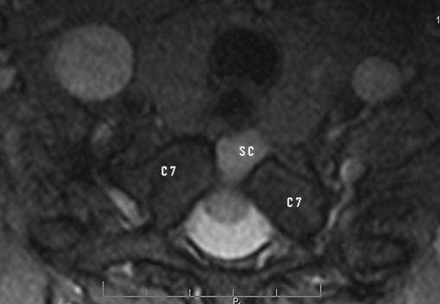 Fig 2.