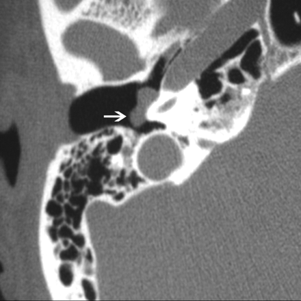 Fig 1.