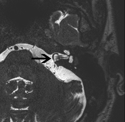 Fig 10.
