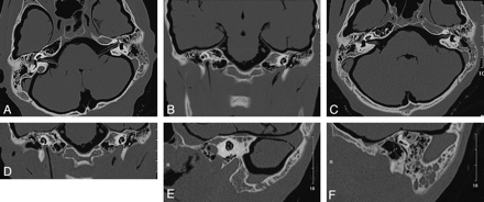 Fig 2.
