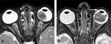 Fig 2.
