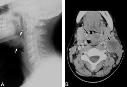 Fig 1.