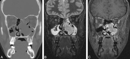 Fig 3.