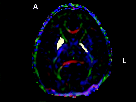 Fig 1.