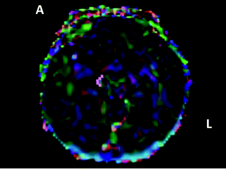 Fig 2.