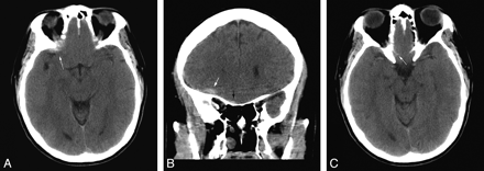 Fig 1.