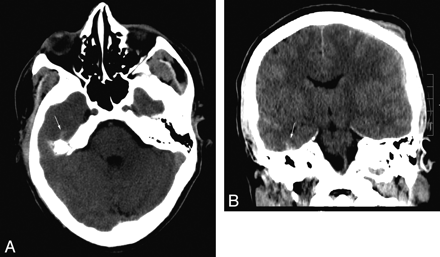Fig 2.