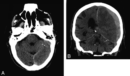 Fig 5.