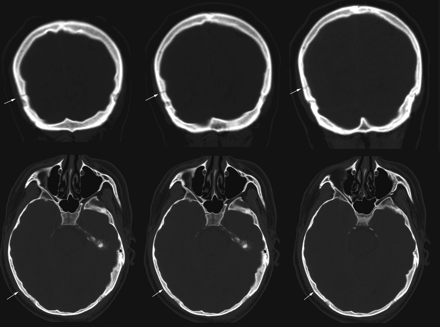 Fig 7.