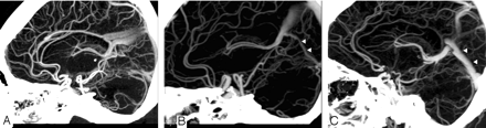 Fig 1.