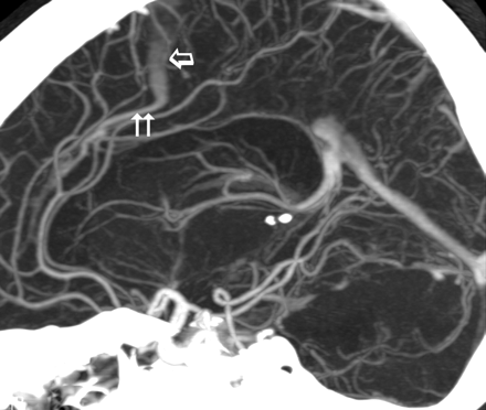 Fig 2.
