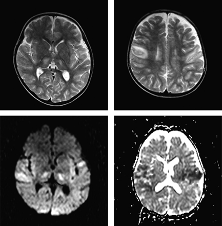 Fig 1.
