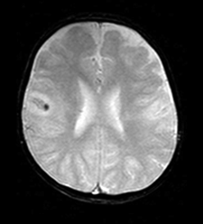 Fig 3.