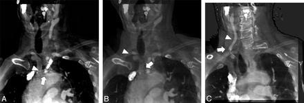 Fig 1.