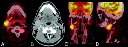 Fig 3.