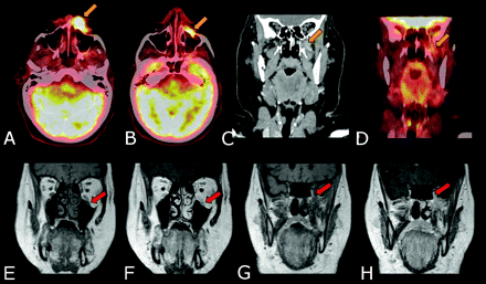 Fig 4.