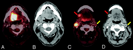 Fig 5.
